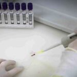 Exames descartam ebola em imigrante do Congo