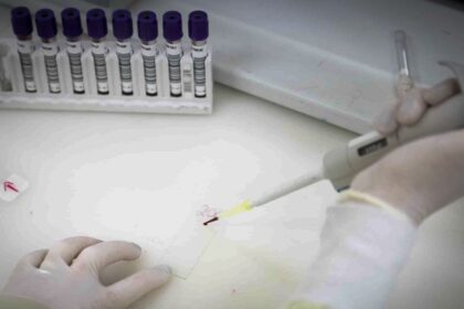 Exames descartam ebola em imigrante do Congo